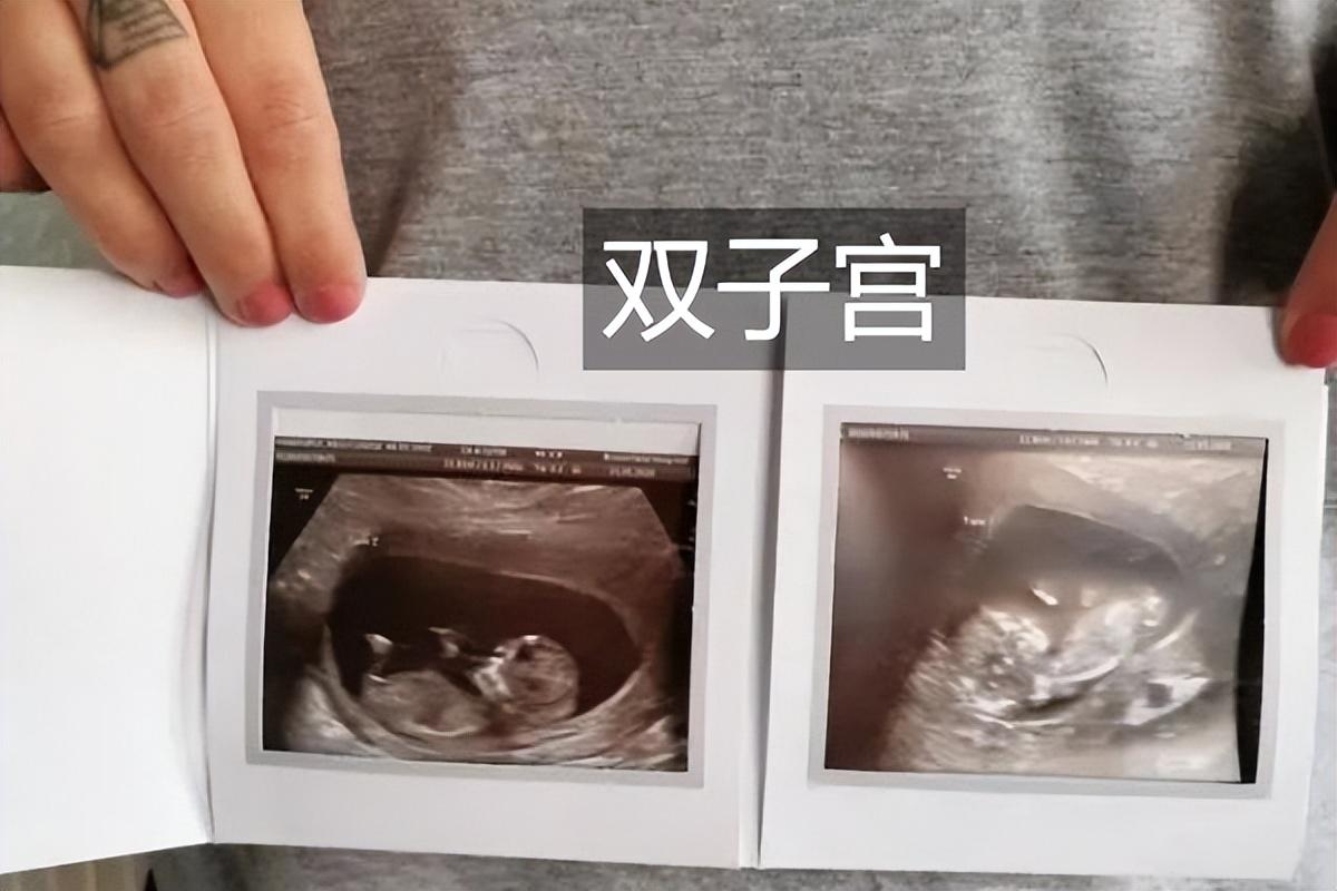 小山俩坐青山绿指什么生肖，详细解答、全面解答解释落实